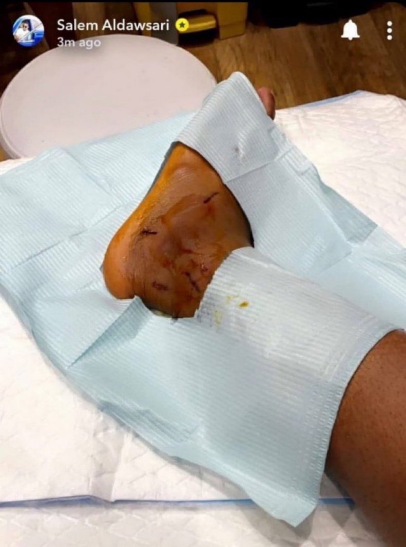 سالم الدوسری فیفادی را از دست داد؛/ شوک به عربستان و الهلال با مصدومیت ستاره - باشگاه خبری ورزشکاران ایران